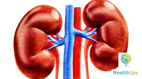 Why Does Kidney Stone Pain Persist for Several Days in a Row?