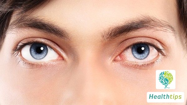 Is Eye Socket Soreness and Tightness a Sign of Dry Eye Syndrome?