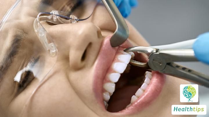 How much does dental implant cost in Beijing?